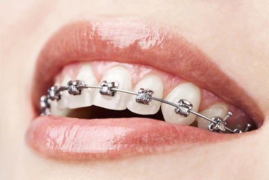 L&#039;orthodontie